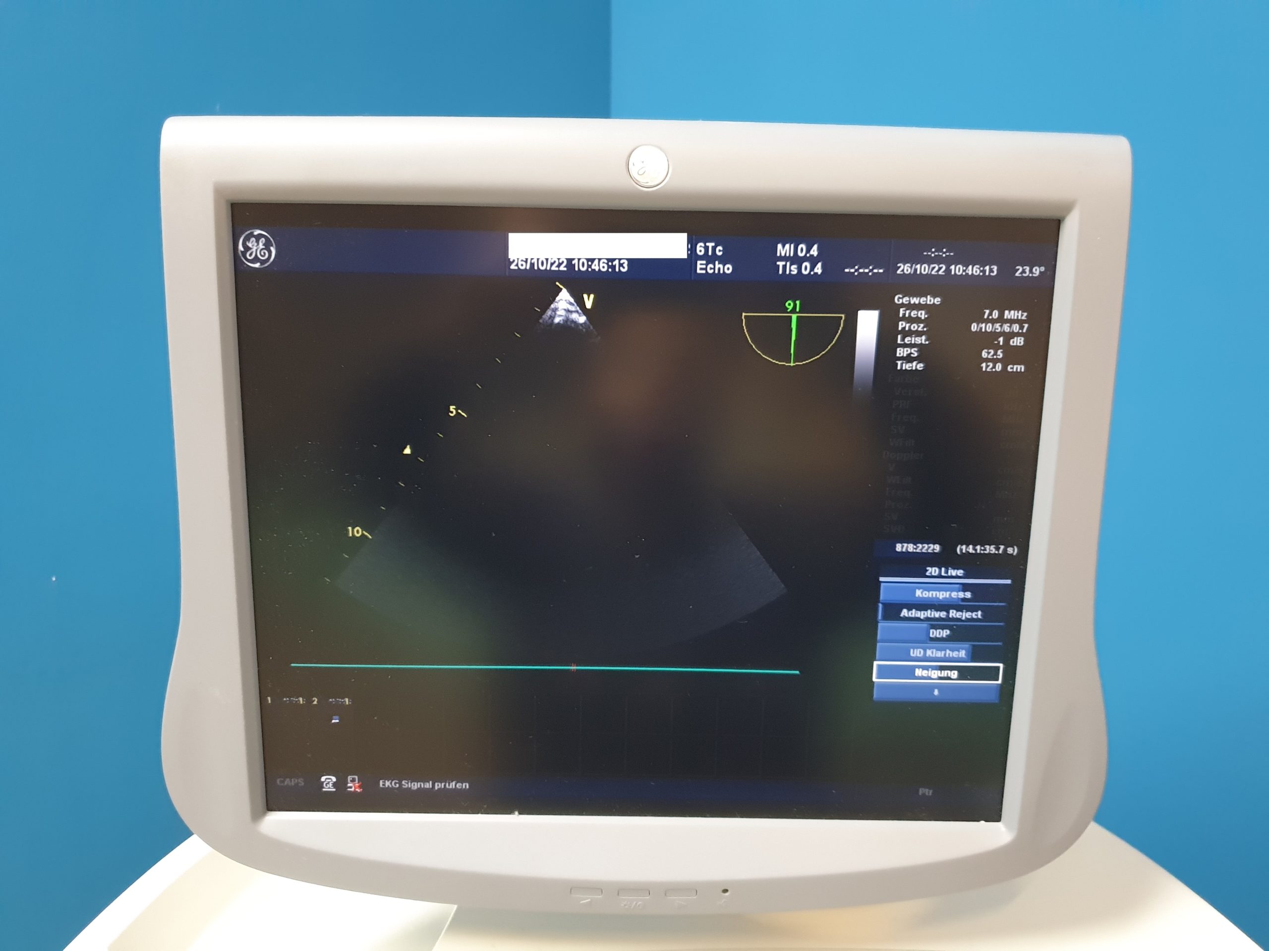 GE Vivid 7 Dimension mit GE M4S Echo Kardio Sonde + 9L Linear + 4C Konvex + 3V Volumencardio + 6TC TEE Sonde thumbnail 15