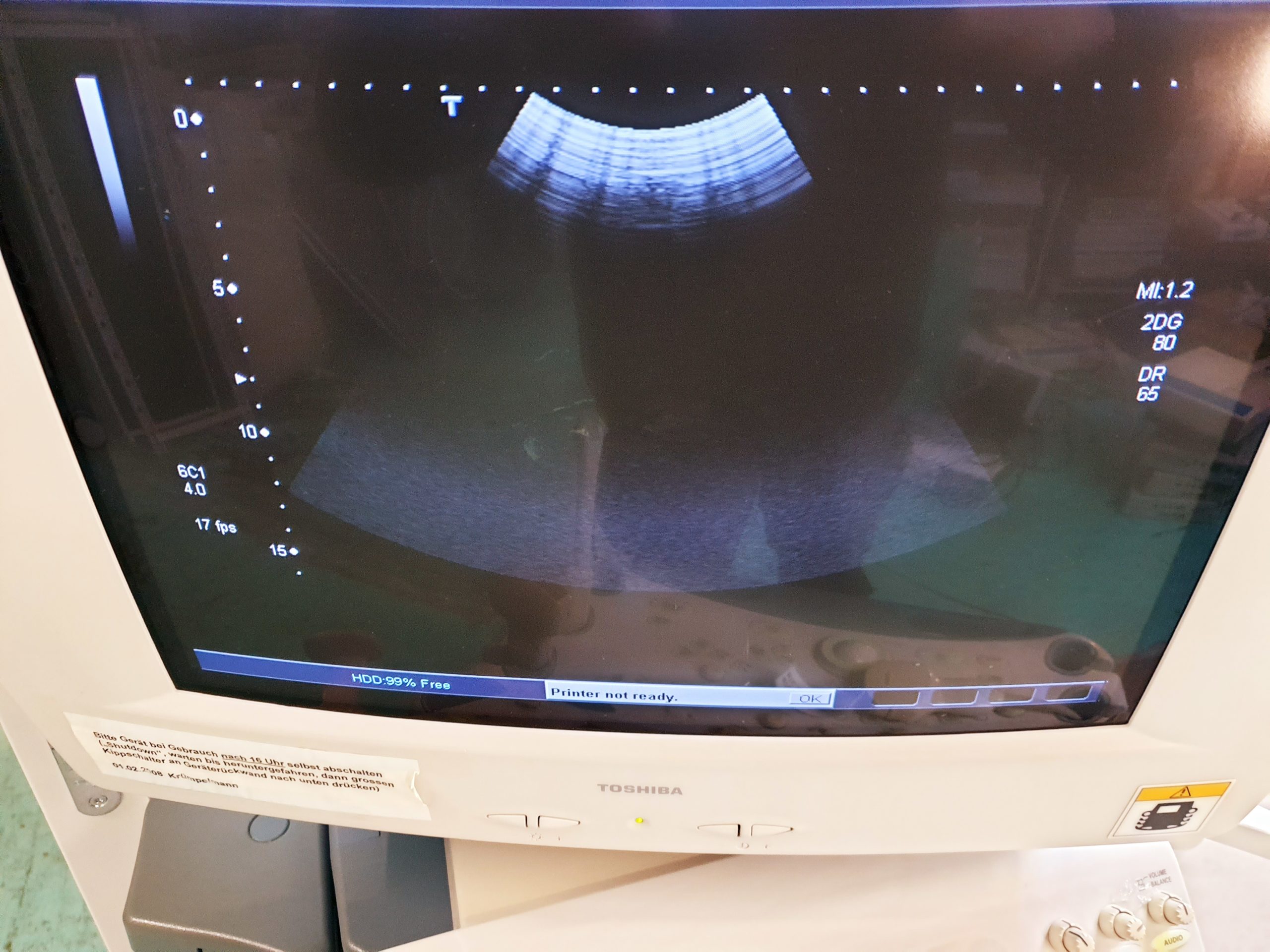 Toshiba PVT-375BT Konvexsonde thumbnail 3