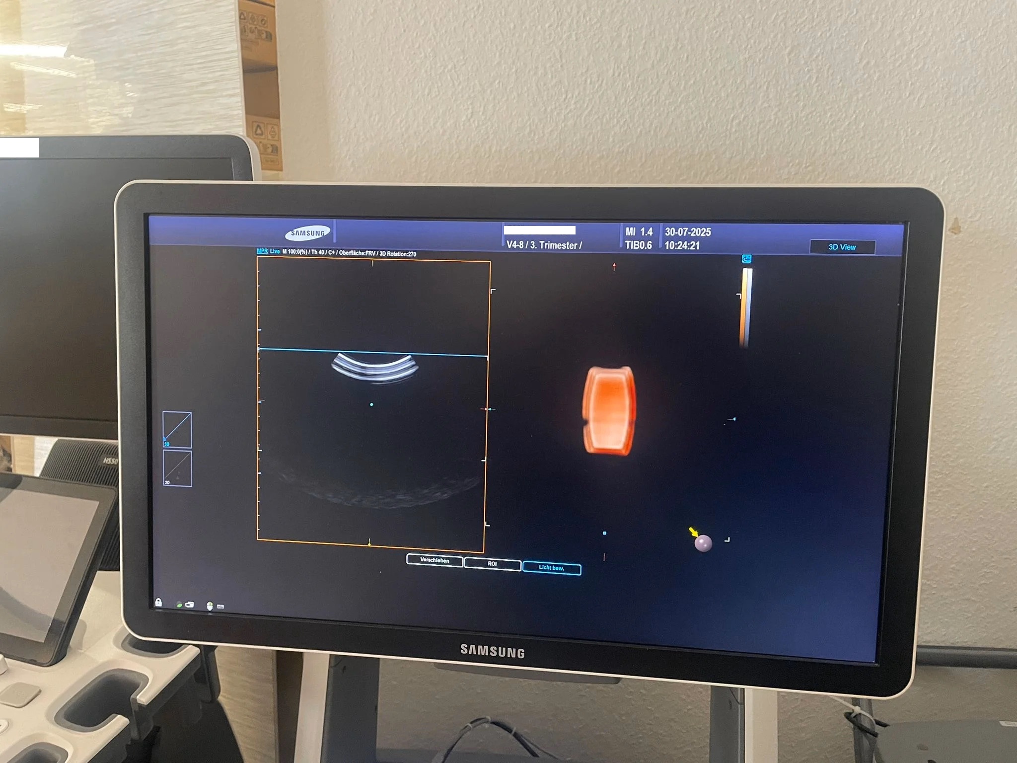 Samsung V4-8 4D Konvexsonde 3D/4D Volumensonde — image 1 of 3