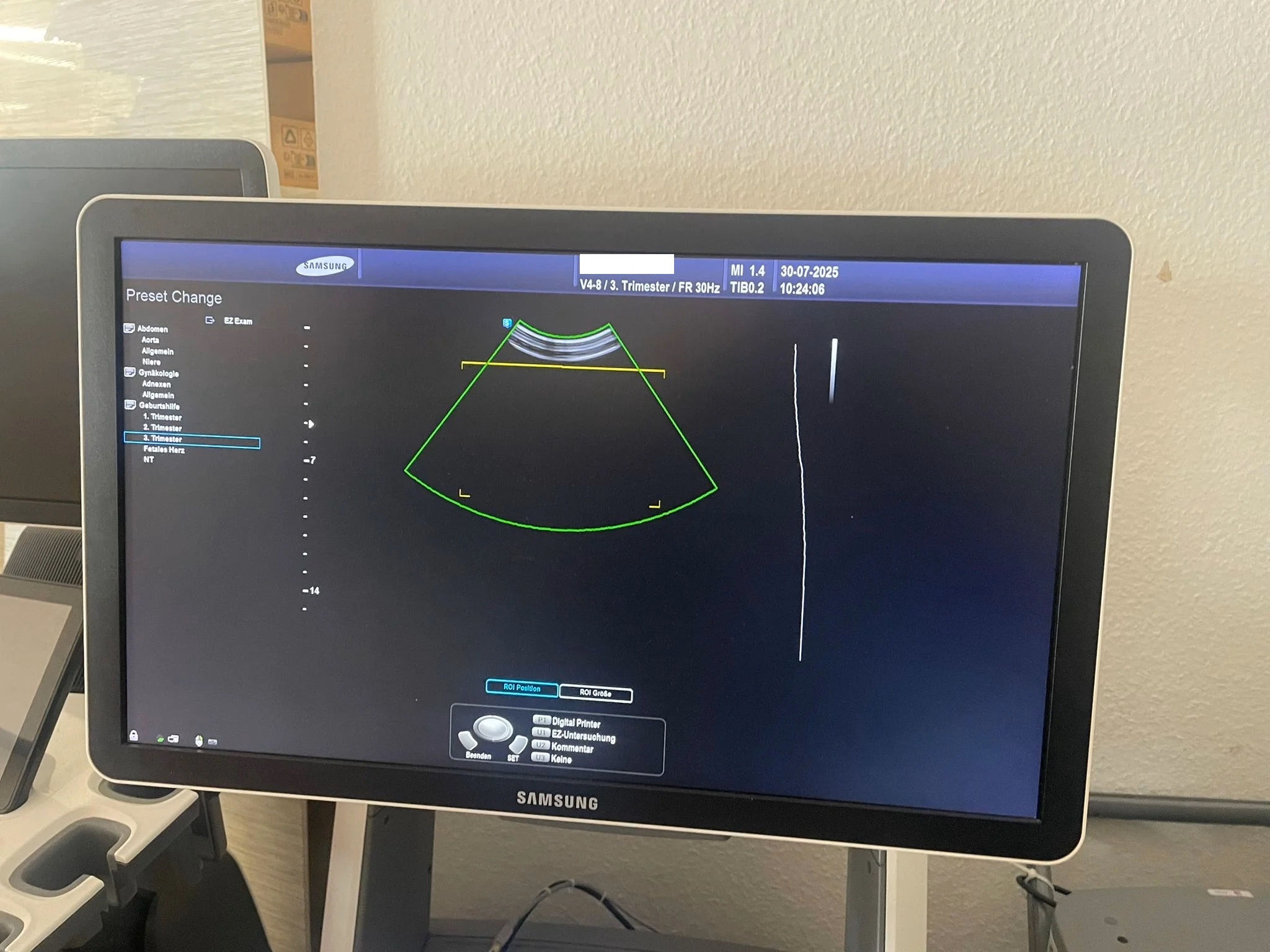 Samsung V4-8 4D Konvexsonde 3D/4D Volumensonde thumbnail 3