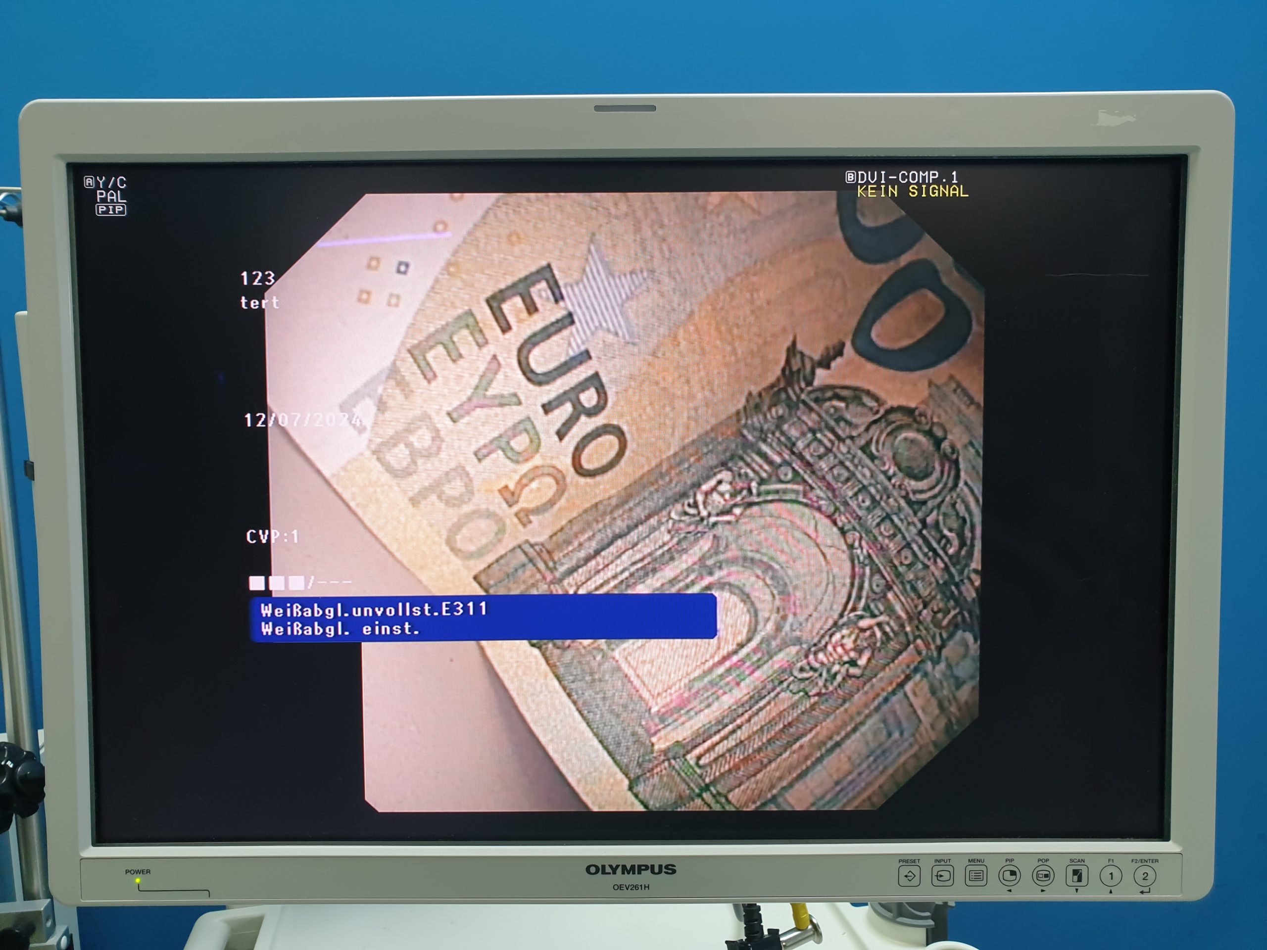 Olympus GF-UCT180 Longitudinales Ultraschallgastroskop thumbnail 21