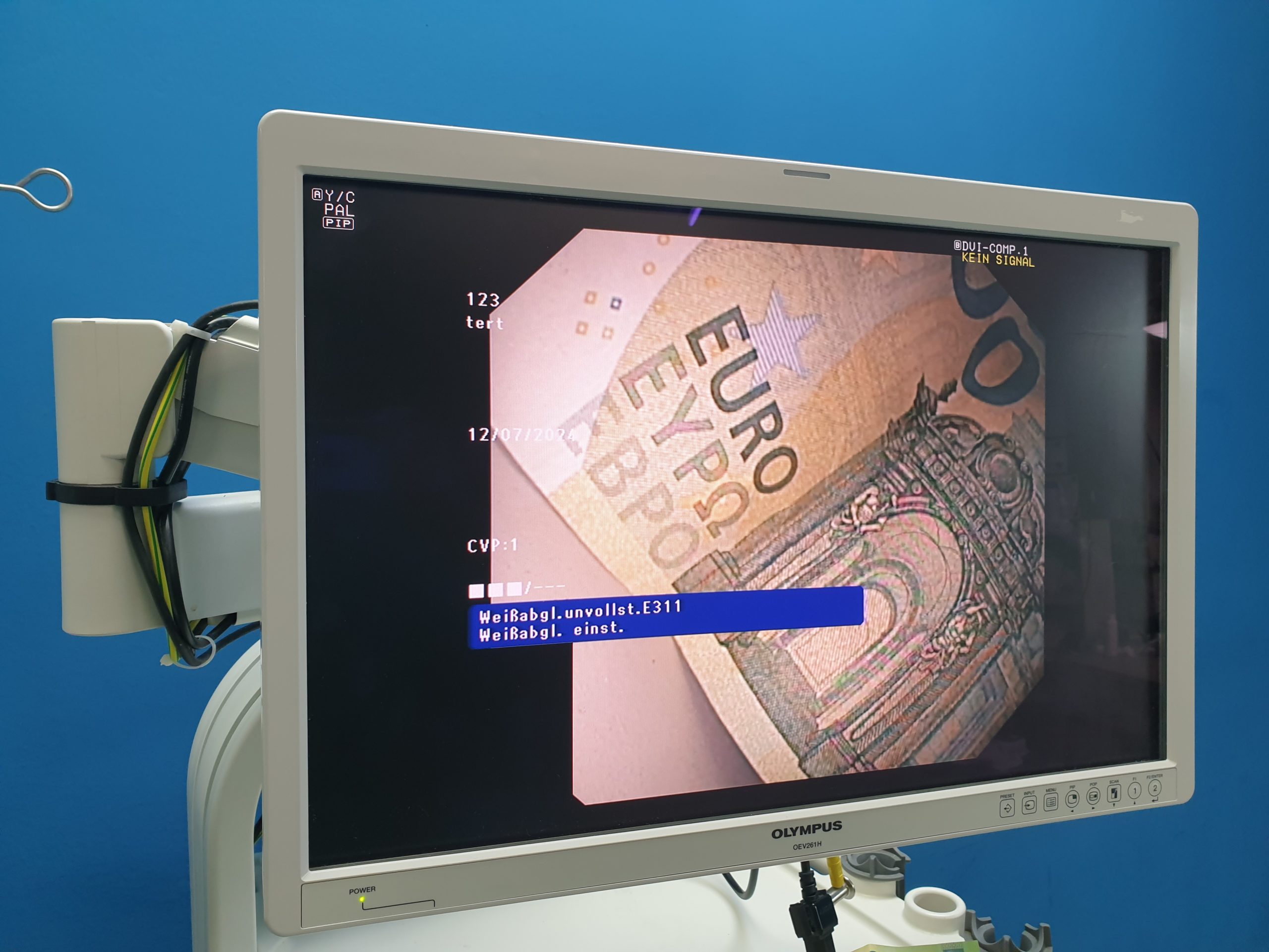 Olympus GF-UCT180 Longitudinales Ultraschallgastroskop thumbnail 22