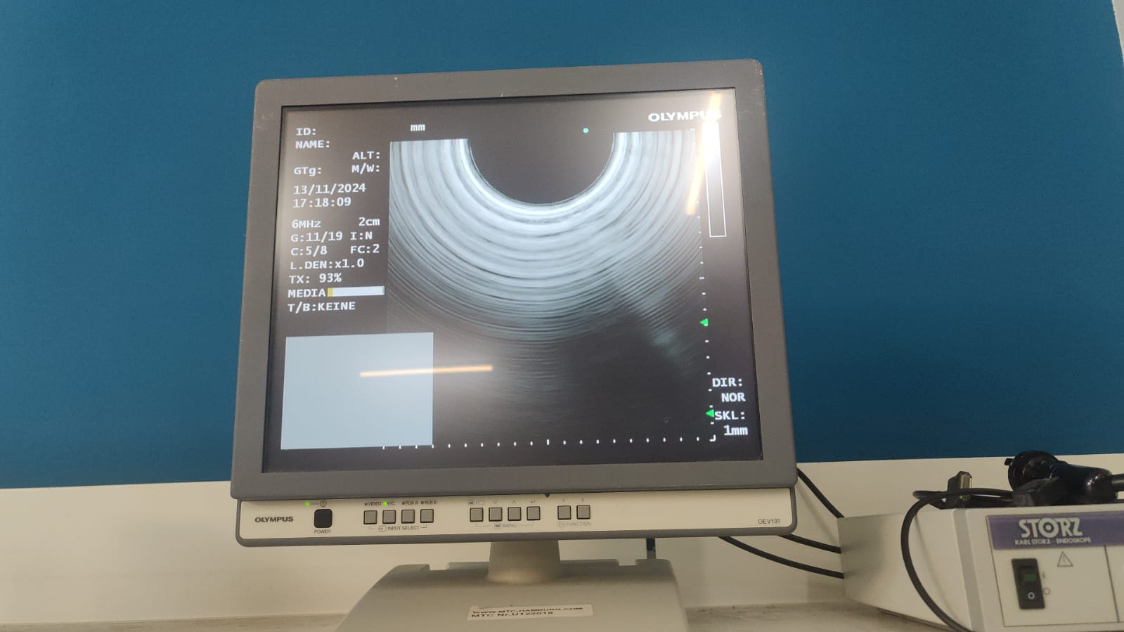 Olympus GF-UCT180 Longitudinales Ultraschallgastroskop thumbnail 23
