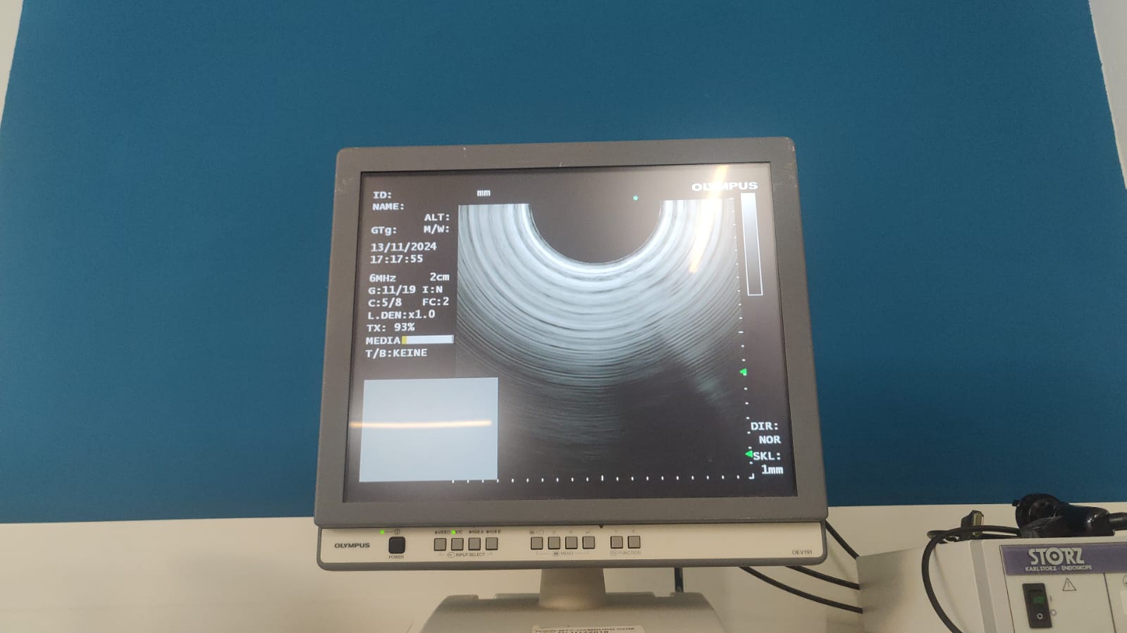 Olympus GF-UCT180 Longitudinales Ultraschallgastroskop thumbnail 24