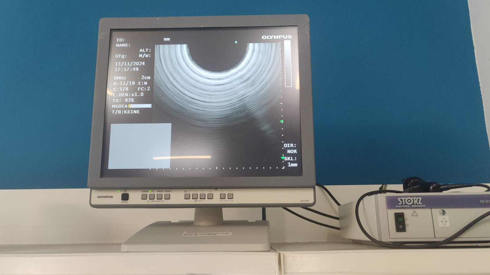 Olympus GF-UCT180 Longitudinales Ultraschallgastroskop thumbnail 25